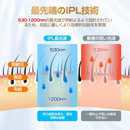 Donamo 脱毛器【サロン級IPL光脱毛器/低刺激でVIO対応】IPL技術