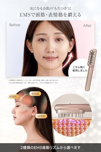 RELX EMS 電気ブラシ 美顔器【日本企業企画】リフトブラシ LED 頭皮ケア 美容家電 ギフト クリスマス プレゼント ローズゴールド 中間 画像