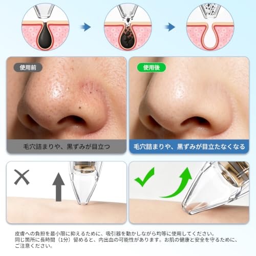 毛穴吸引器【50kPa吸引】毛穴汚れ・角栓ケア 毛穴クリーン 3段階吸引力調整 6種類吸引ヘッド USB充電式 男女兼用 プレゼント 日本語取扱説明書の特徴・詳細 画像